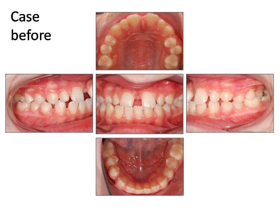 case done by dr mah 2