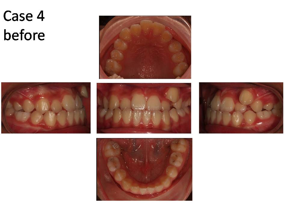 case done by dr mah 3