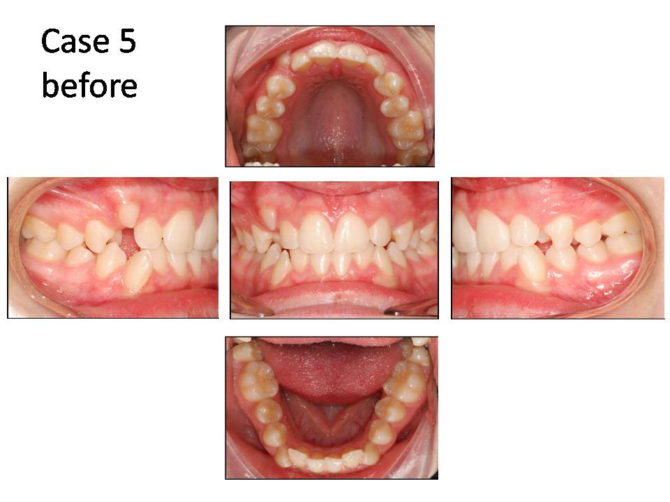 case done by dr mah 5